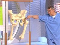 Симптомы разрушения тазобедренного сустава Стерся тазобедренный сустав что делать