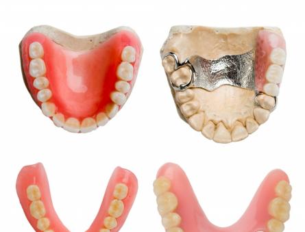 Зуб сверхкомплектный: причины, симптомы и особенности лечения